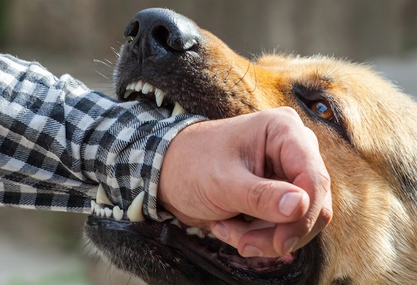 Dog biting a person